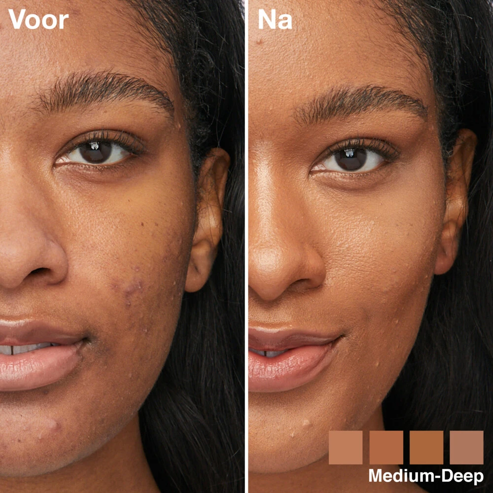 Maybelline Instant Anti-Age Perfector 4-in-1 Glow Medium Deep - Primer, Concealer, Highlighter En BB-Cream In één 6 Maybelline Instant Anti-Age Perfector 4-in-1 Glow Medium Deep - Primer, Concealer, Highlighter En BB-Cream In één - Afbeelding 4